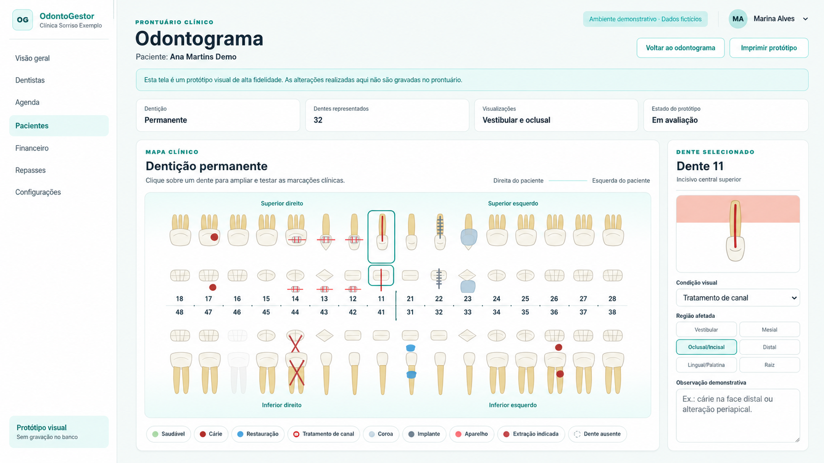 Odontograma demonstrativo do OdontoGestor com dentição permanente e marcações clínicas fictícias